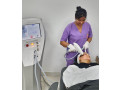 Carbon Laser Facial (Hollywood / China Doll Facial)