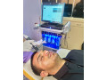 Carbon Laser Facial (Hollywood 0& China Doll Facial)