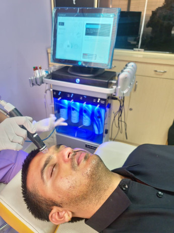 Carbon Laser Facial (Hollywood 0& China Doll Facial)